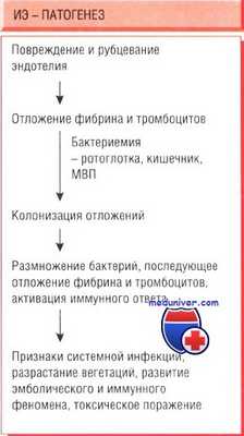 эндокардит