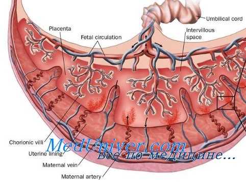 мезентеральный тромбоз