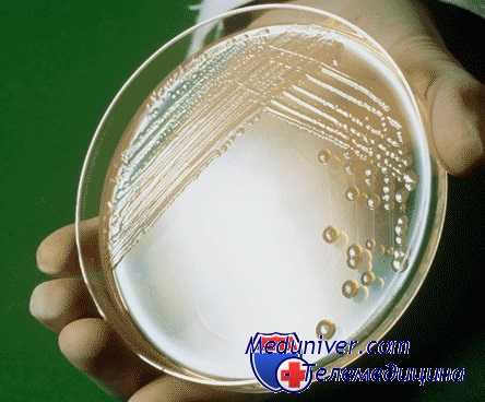 мезентериальный тромбоз