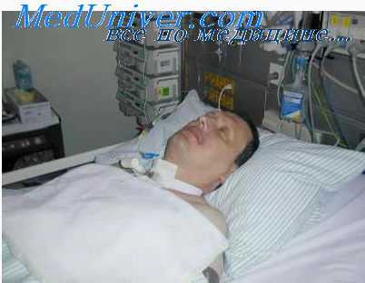 недостаточность мозгового кровообращения