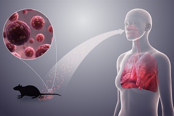 Хантавирус