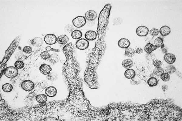 Хантавирус.