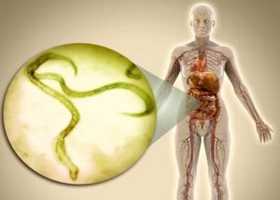 Гименолепидоз