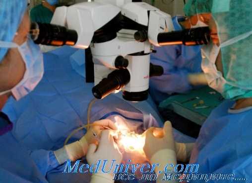 установка инфузионных канюль в офтальмохирургии