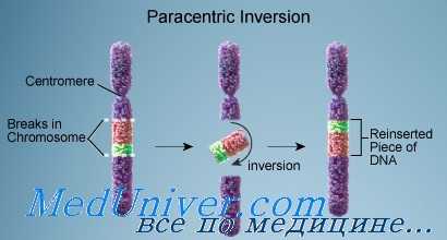 Парацентрическая инверсия