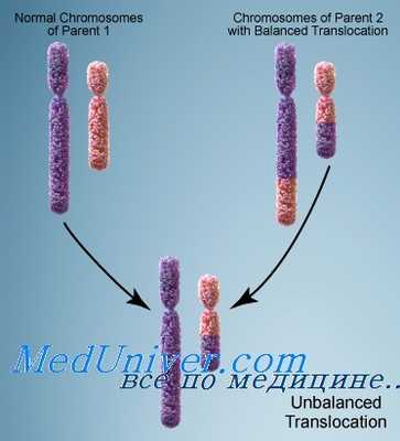 Схема транслокации