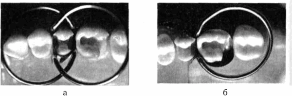 Секционная матричная система