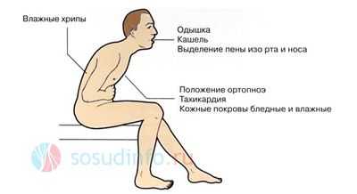 Кардиогенный шок