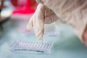 Анализ цитокинового профиля (интерлейкины) в RT-PCR