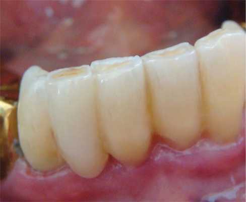 Рис. 9. После отверждения пигменты покрыты прозрачным эмалевым фотополимером.