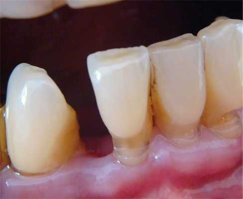 Рис. 1. Исходная клиническая ситуация.