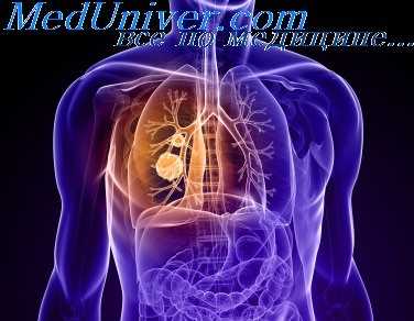 перевязка сосудов