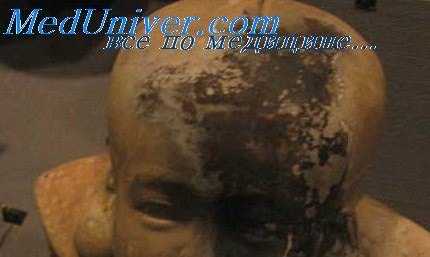 поступление полония