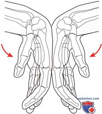 Неврологическое исследование запястья и кисти