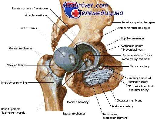 ишемический некроз головки бедра
