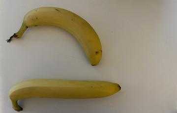 Вентральное искривление пениса