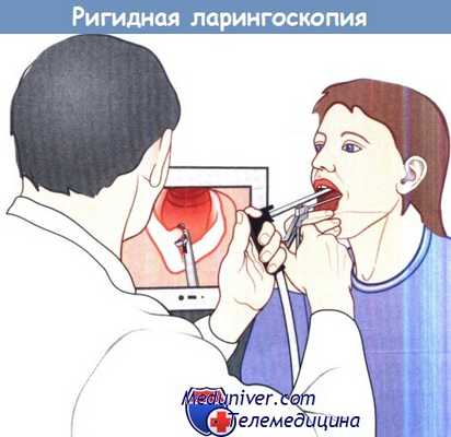 Ригидная ларингоскопия