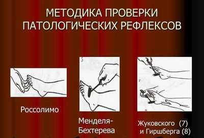 Проверка патологических рефлексов