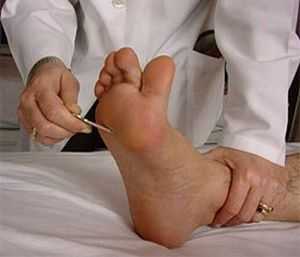 рефлекс бабинского