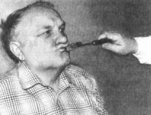 Хоботковый симптом