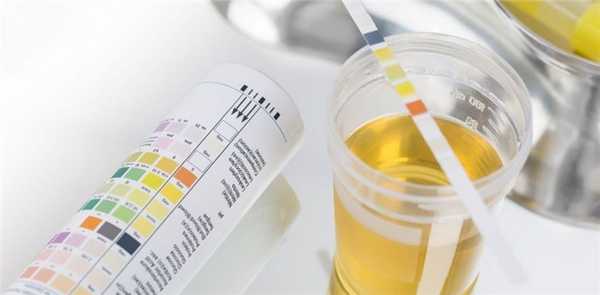 Анализ мочи на лейкоциты