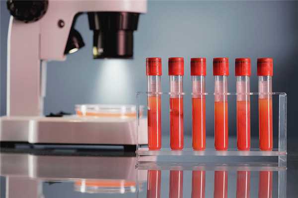 You are currently viewing Морфология мазка - нормы и результаты анализа крови с мазком