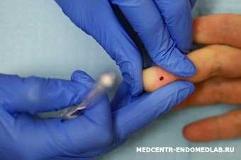 кровь из пальца, анализ крови