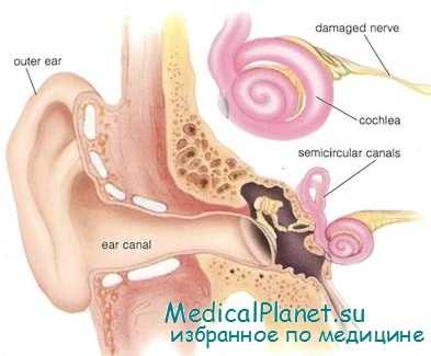 нарушения речи
