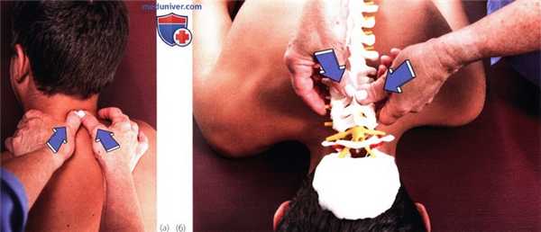 Исследование подвижности в шейном отделе позвоночника