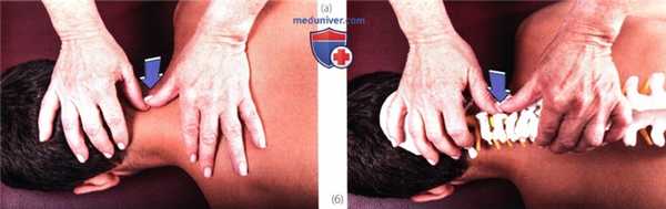 Исследование подвижности в шейном отделе позвоночника