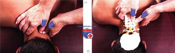 Исследование подвижности в шейном отделе позвоночника