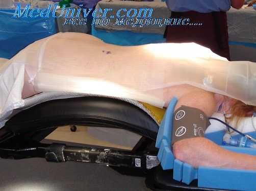 пальпация поперечной ободочной кишки