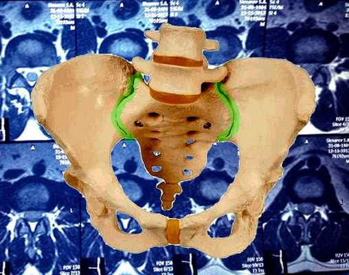 Модель таза. КПС обозначены зеленым цветом