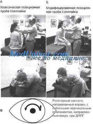 исследование позиционных проб при головокружении