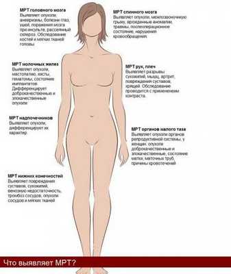 Какие заболевания выявляют с помощью МРТ
