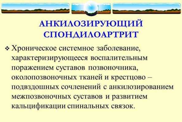 Спондилоартрит анкилозирующий
