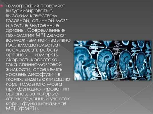 Зачем проходить процедуру МРТ