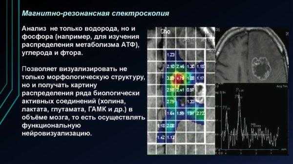 Магнитно-резонансная спектроскопия
