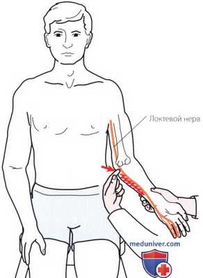 Неврологическое исследование локтевого сустава
