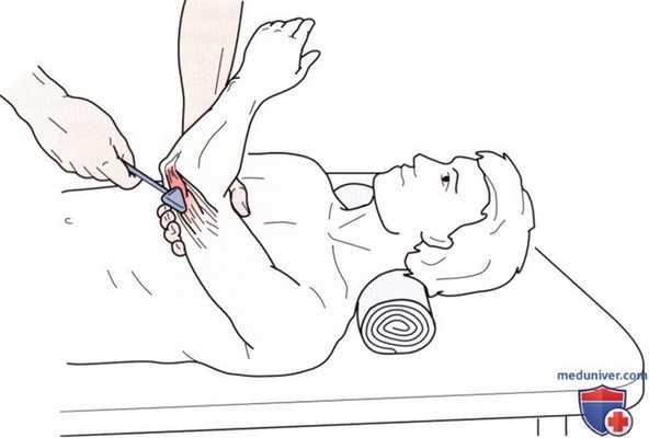 Неврологическое исследование локтевого сустава