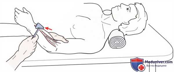 Неврологическое исследование локтевого сустава