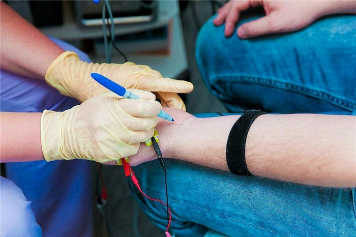 ЭНМГ обследование верхних конечностей