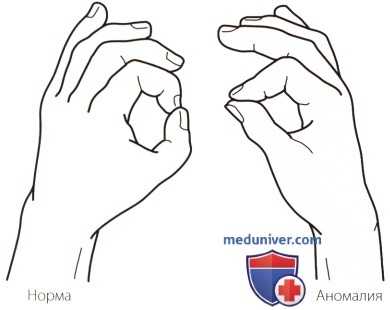 Неврологическое исследование локтевого сустава