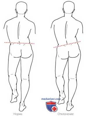 Тесты на пластичность тазобедренного сустава