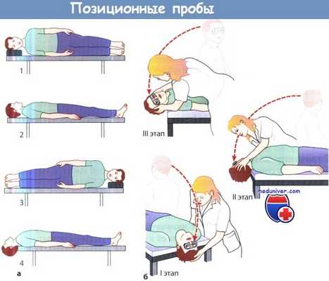 Статическая и динамическая позиционная проба