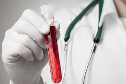 Сдать анализы перед операцией на глаза