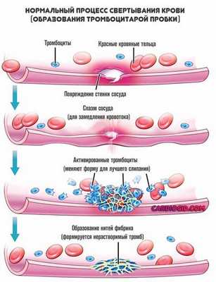 свертывание-крови