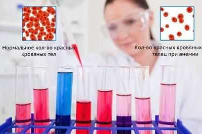 Отравление цианидами