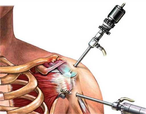 Преимущества и недостатки методики