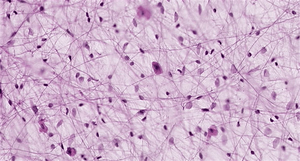 «Коллагеновый лес»